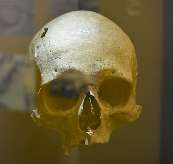 Cráneo procedente de Marialba de la Ribera. Museo de León