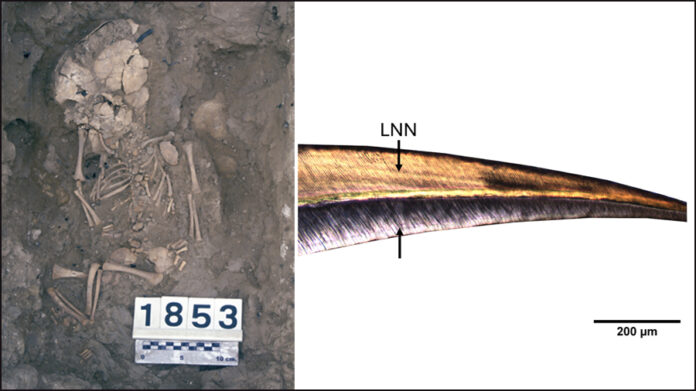 Entierro de un individuo con muerte perinatal del yacimiento de la Fortaleza de Els Vilars (Arbeca, Lleida). Crédito: ARQHISTEC-GIP, UdL. Derecha: Línea neonatal en el diente incisivo central de un bebé del yacimiento de Olèrdola (Alt Penedès). Crédito: Unidad de Antropología Biológica, UAB. Entierro de un individuo con muerte perinatal del yacimiento de la Fortaleza de Els Vilars (Arbeca, Lleida). Crédito: ARQHISTEC-GIP, UdL. Derecha: Línea neonatal en el diente incisivo central de un bebé del yacimiento de Olèrdola (Alt Penedès). Crédito: Unidad de Antropología Biológica, UAB.