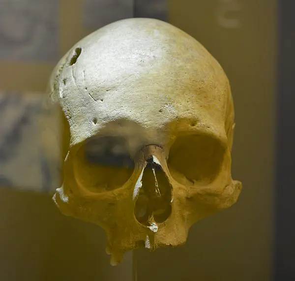Cráneo procedente de Marialba de la Ribera. Museo de León